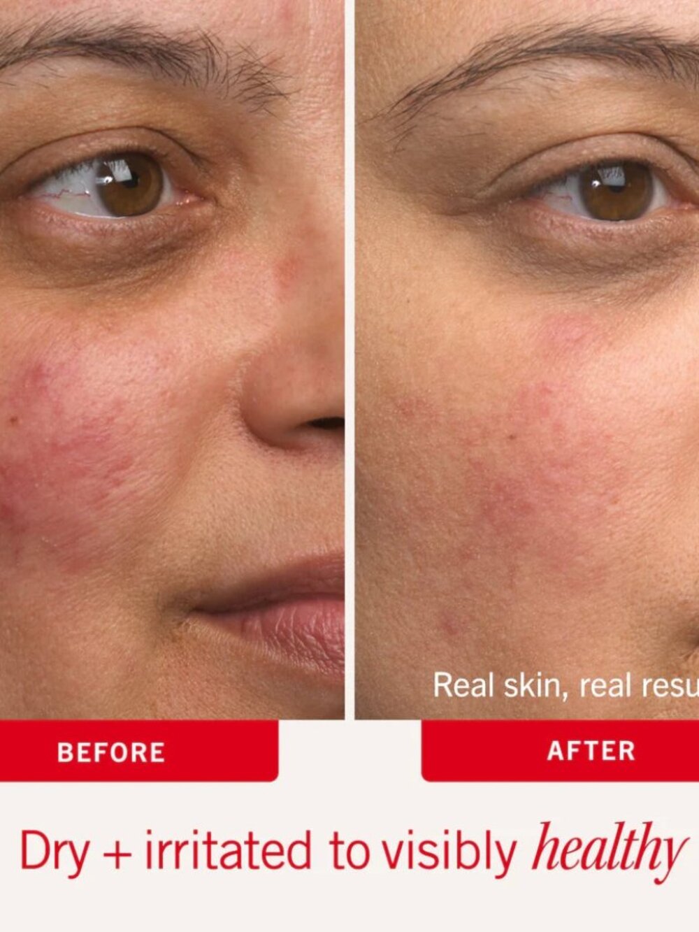 First Aid Beauty Skincare Set-Ultra Repair Cream Intense Hydration Skin-2pc-NEW - Picture 9 of 16